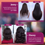 HAIR GROWTH™ — ¡2 + 1 GRATIS por tiempo limitado! ⏰
